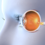 Optic nerve atrophy treatment using umbilical cord stem cells