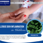 Probiotics in Allergic Skin Inflammation Treament in Children