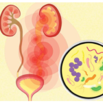 Probiotics Applications in Urinary Tract Infections Treatment