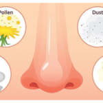 Application of probiotics in the treatment of allergic rhinitis